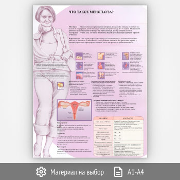 Плакат «Что такое менопауза?» (ЗОЖ-17, 1 лист)