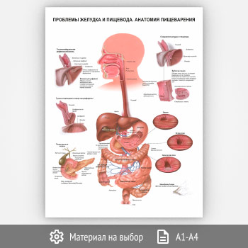 Плакат «Проблемы желудка и пищевода. Анатомия пищеварения» (ЗОЖ-34, 1 лист)