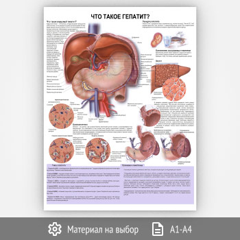Плакат «Что такое гепатит?» (ЗОЖ-38, 1 лист)